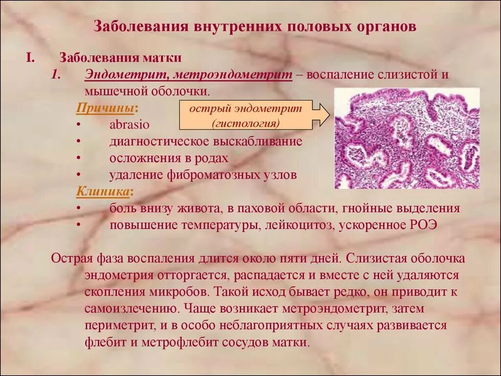 воспаление женских половых органов. снять внутреннее воспаление. заболевания женских половых органов. воспаление в организме симптомы. воспалительные заболевания женских.