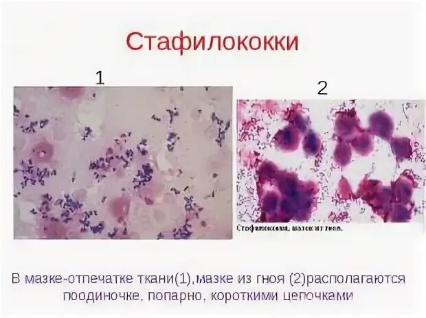 Streptococcus в мазке у мужчин. Стретококки саливарис.