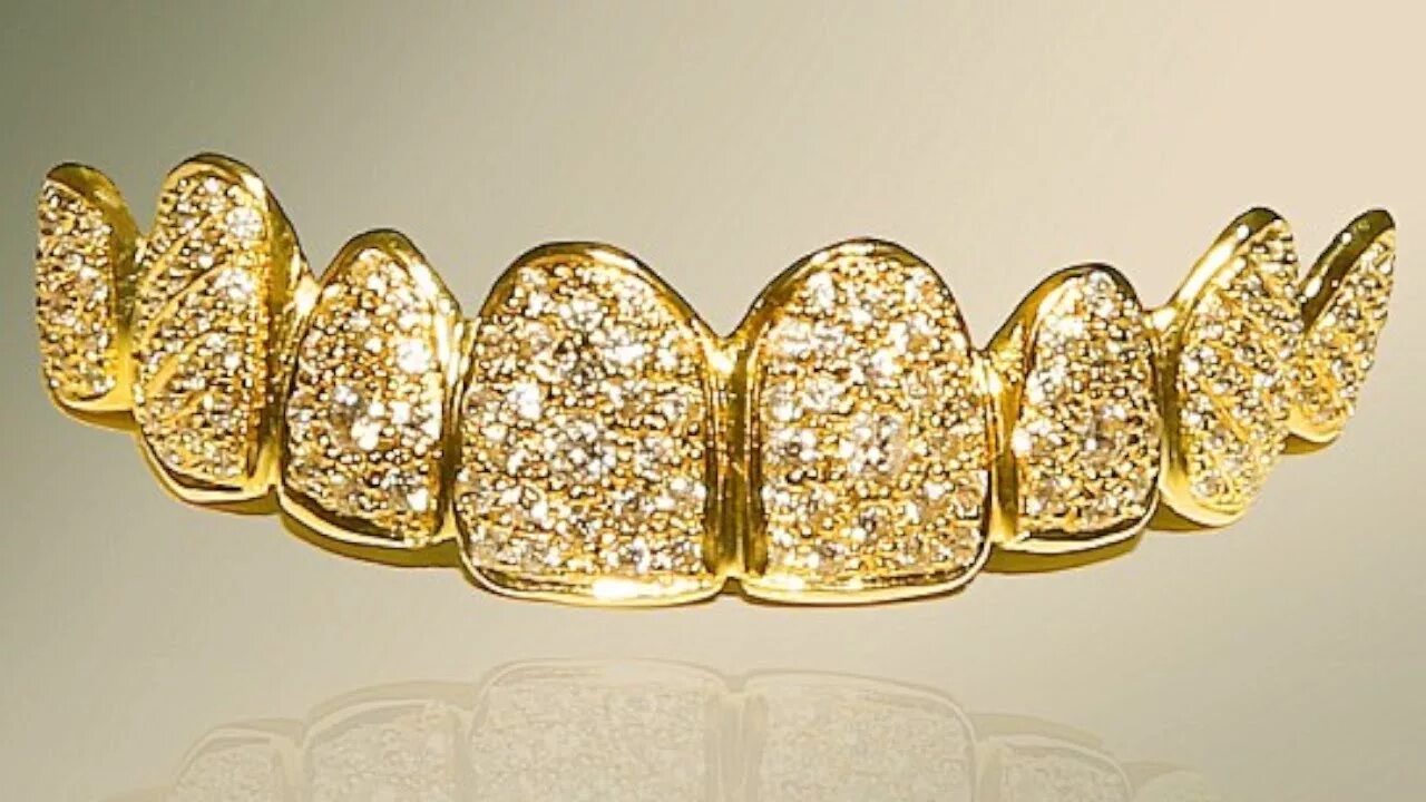 Какое золото внутри. Золотые коронки. Позолоченные зубы. Золото в стоматологии. Золотистые коронки.