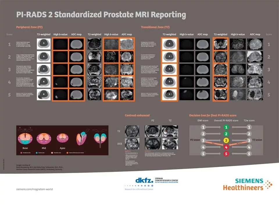Rads 4 предстательной железы. Pi-rads 2.1 классификация. Pirads классификация. Pirads мрт. Pirads шкала.