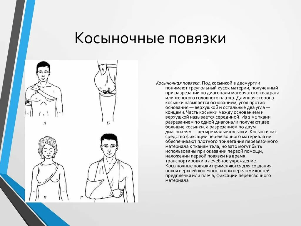 При вывихе плеча применяют повязку косыночную