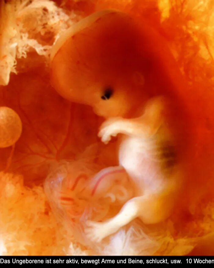 Эмбрион в 4 месяца беременности фото. Эмбрион на 10 неделе беременности. Зародыш на 3 месяце беременности.