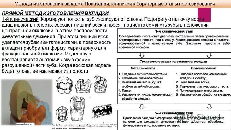 Прямой метод изготовления вкладок. Клинико-лабораторные этапы изготовления вкладок. Клинико лабораторные этапы вкладки. Клинико лабораторные методы изготовления вкладок.