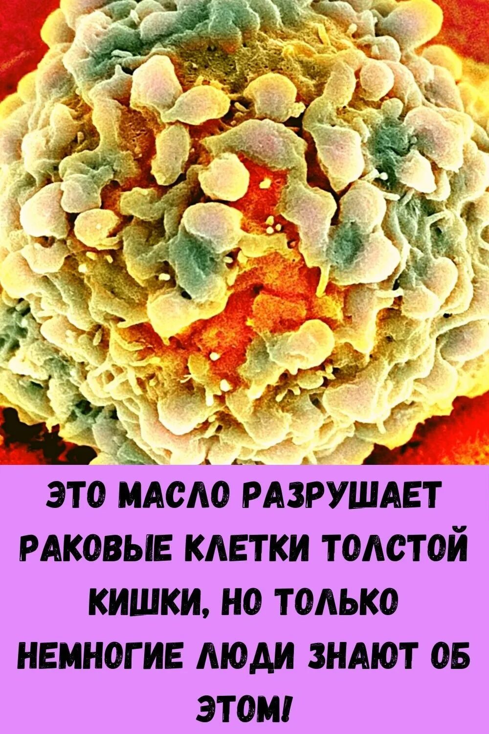 Раковые клетки в кишечнике. Продукты которые убивают раковые клетки. Пища разрушить