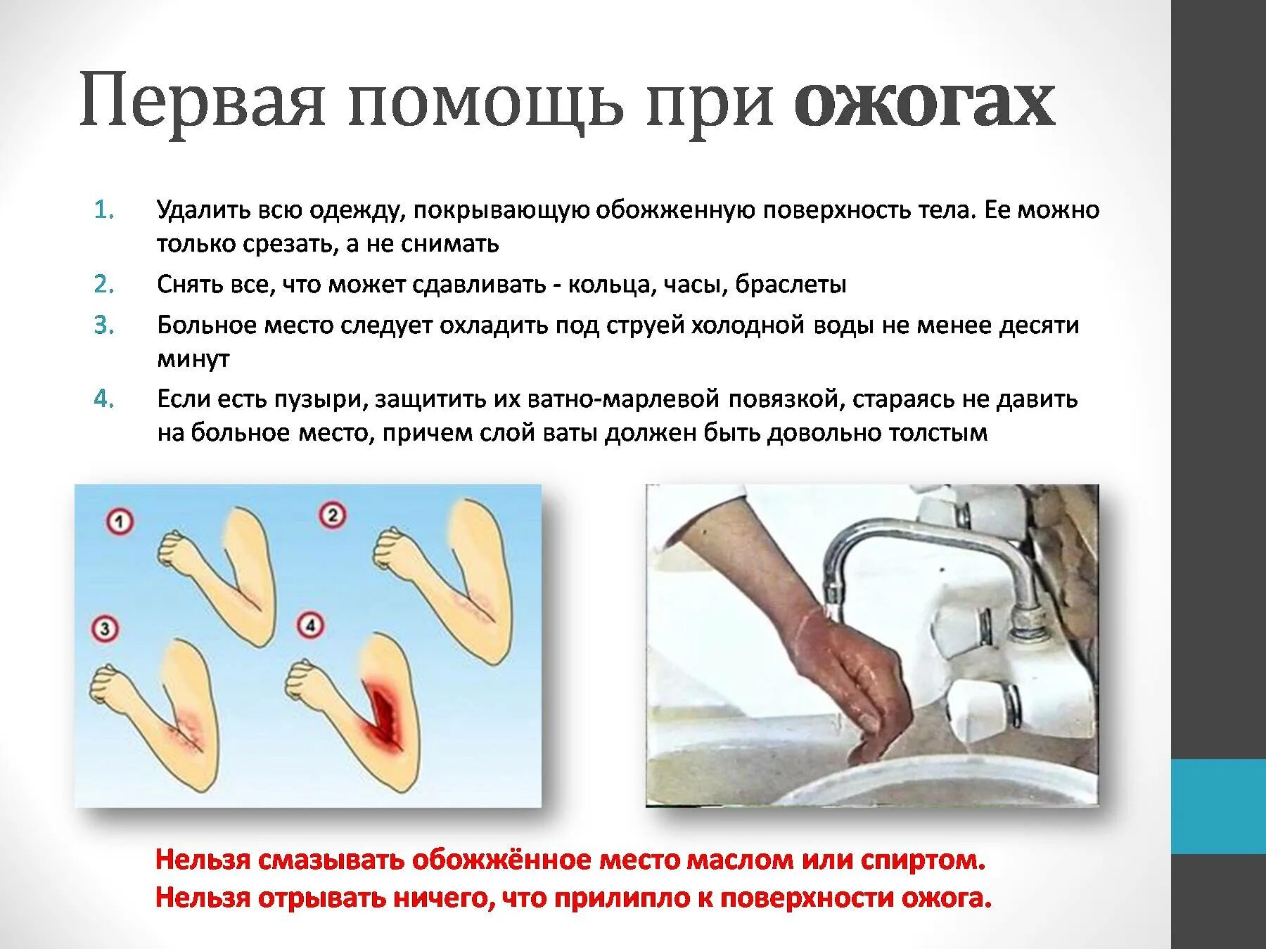 1 помощь при сильном ожоге. Оказание первой помощи при ожогах. Памятка ожоги. Памятка первая помощь при ожогах. Памятка помощь при химических ожогах.