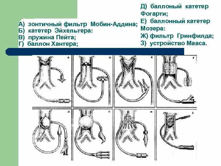 Катетер фогарти. Катетер балонный для тромбэктомии. Баллон катетер Фогарти. Зонд Фогарти. Катетер Фогарти холедохотомия.