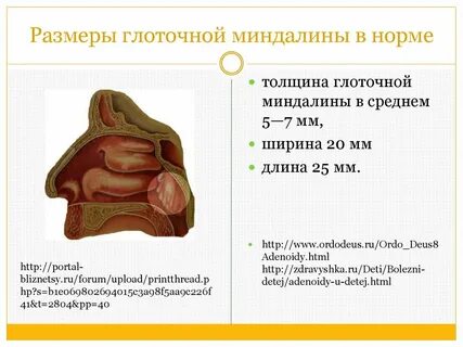 Глоточная миндалина