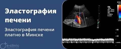 Где сделать эластометрию печени в нижнем новгороде