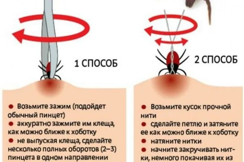 Как вытащить клеща у человека в домашних. Как убрать клеща с человека ниткой. Как вытащить клеща у человека в домашних условиях правильно. Как удалить клеща у человека ниткой. Удалить клеща ниткой у человека.