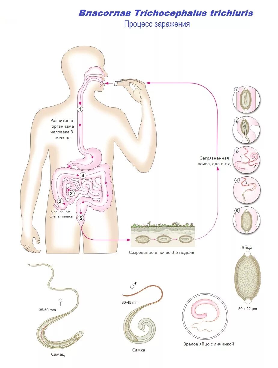 Власоглав симптомы. Цикл развития власоглава человеческого схема. Цикл развития власоглава схема. Власоглав человеческий яйца. Жизненный цикл власоглава схема.