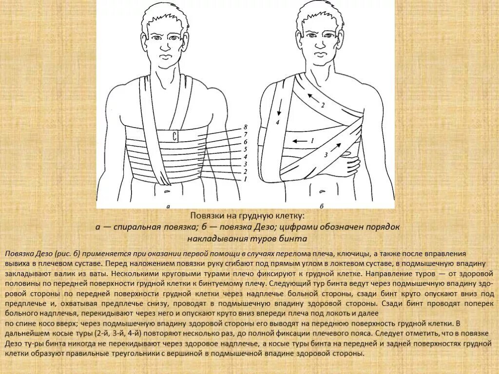 Плечевая повязка алгоритм. Схема наложения повязки Дезо. Алгоритм наложения повязки Дезо при переломе ключицы. Наложение повязки Дезо алгоритм. Дезо алгоритм наложения.