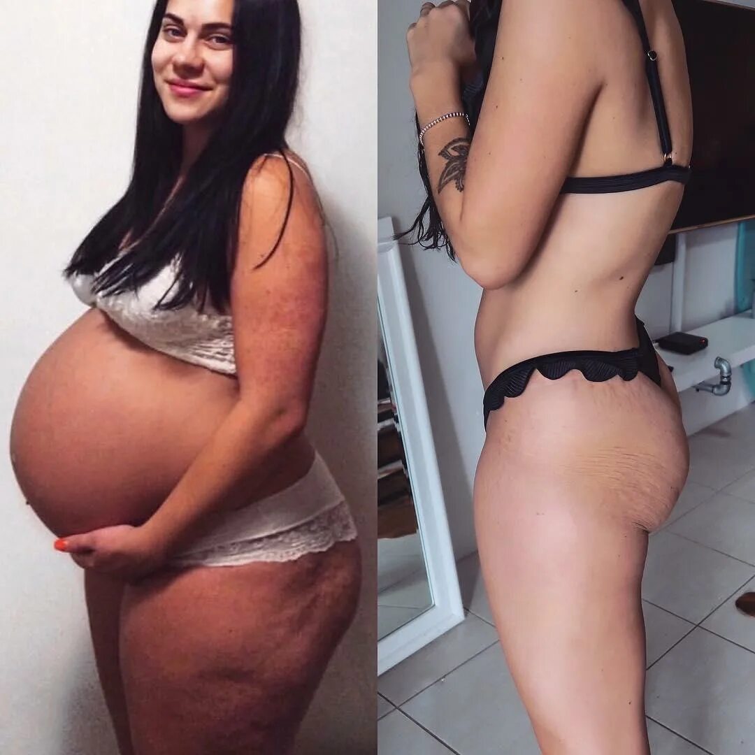 После беременности. Фигура после родов. Фигура до и после родов. Девушки после родов фигура.