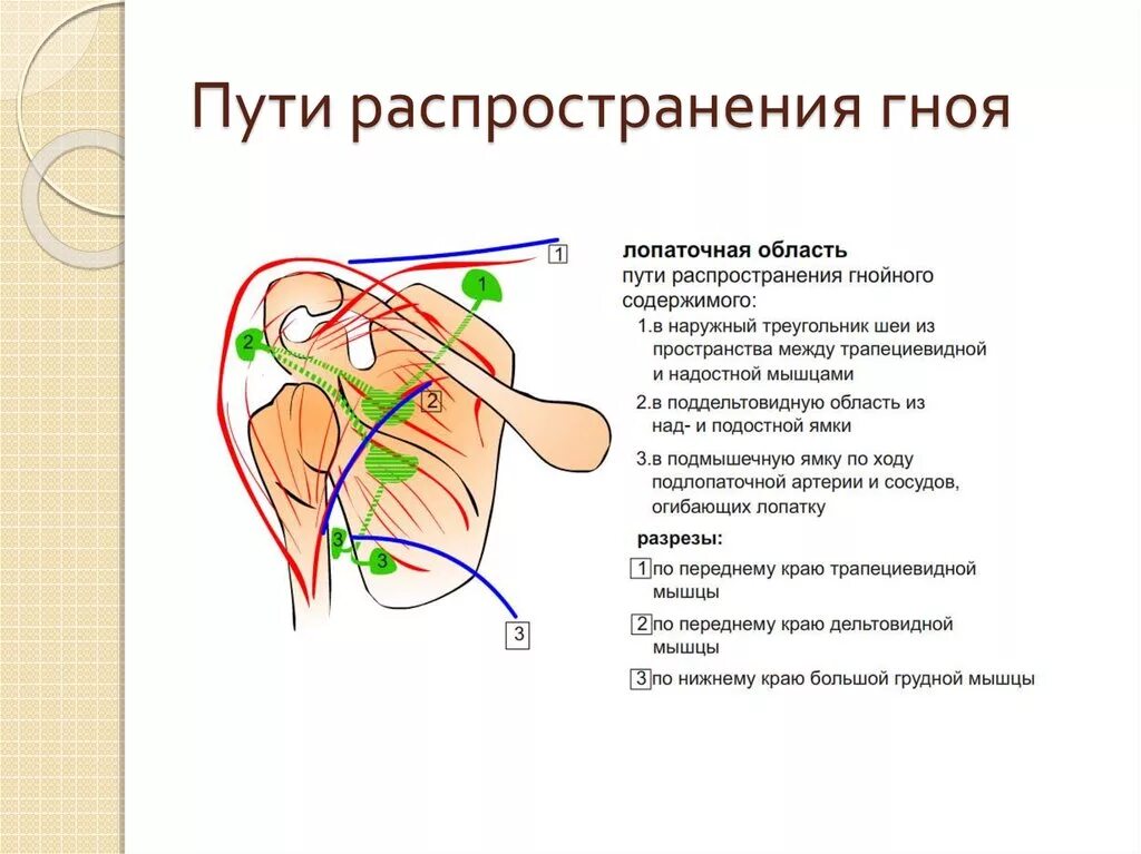 Картинки ВСКРЫТИЕ ЛИНИИ