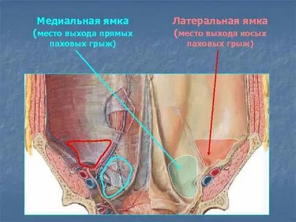 Нижняя стенка пахового канала образована