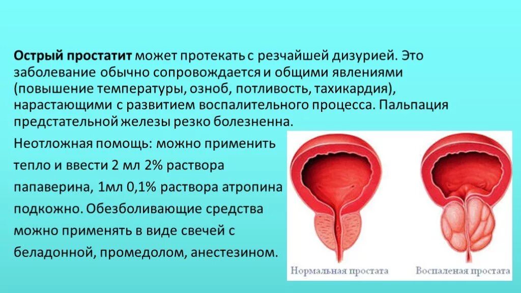 Острые простаты. Простатит презентация. Острый и хронический простатит. Острый паренхиматозный простатит.