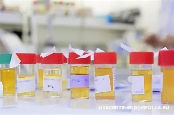 Проба нечипоренко микрогематурия. Проба зимницкого. Проба зимницкого баночки. Методы исследования мочи по зимницкому. Алгоритм сбора мочи на анализ по методу зимницкого.