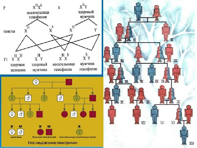 Женщина гемофилик. Мужчина гемофилик и здоровая женщина схема наследования.