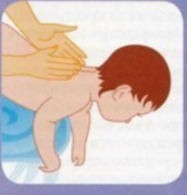 Ребенок не может откашлять мокроту. Дренажный массаж ребенку для отхождения мокроты. Дренажный массаж ребенку для отхождения. Массаж для отхождения мокроты у ребенка 4 года. Вибрационный массаж ребенку для отхождения мокроты при кашле у детей.