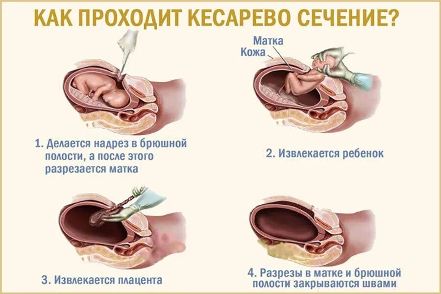 Когда можно садиться после операции