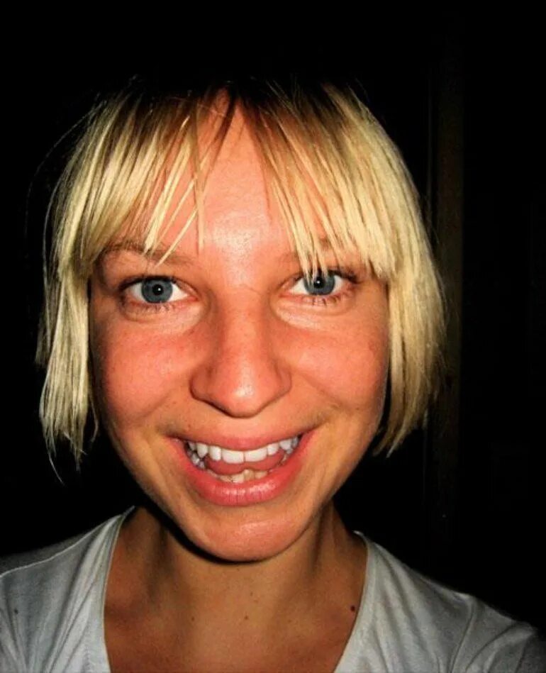 Сия зубы. Sia певица 2021. Сия зубы. Певица сиа лицо. Сия зубы.