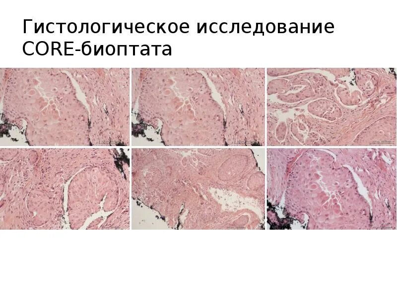 Срочное гистологическое исследование. Гистология лаборатория. Лейкемиды гистологическая. Гистологическое исследование. Гистологическое исследование молочной железы.
