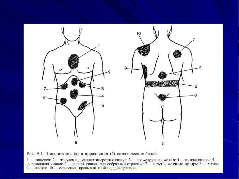 Заболевания локализация боли. Панкреатит иррадиация болей. Локализация боли при различных заболеваниях. Боль в желудке локализация.