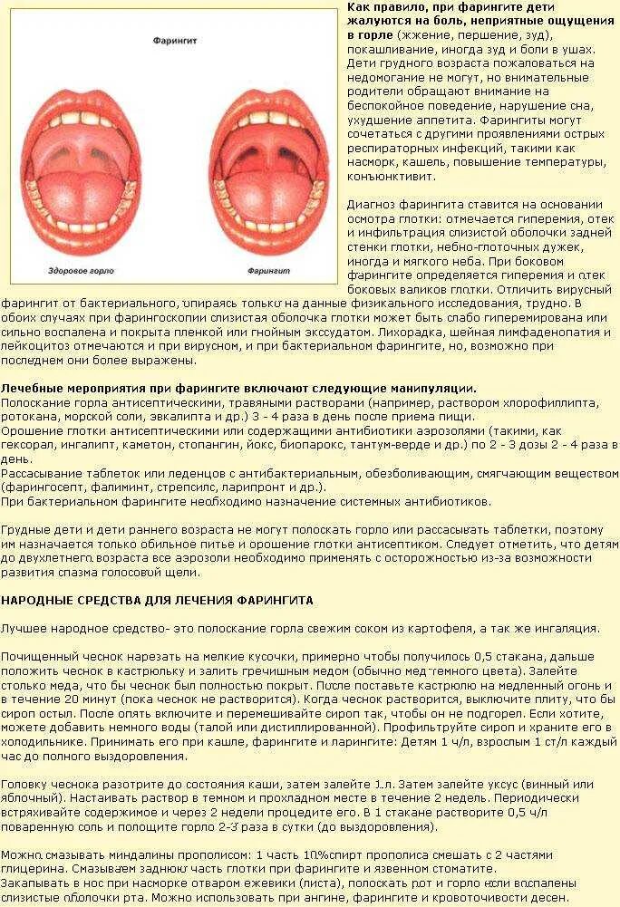 Первая помощь при ангине