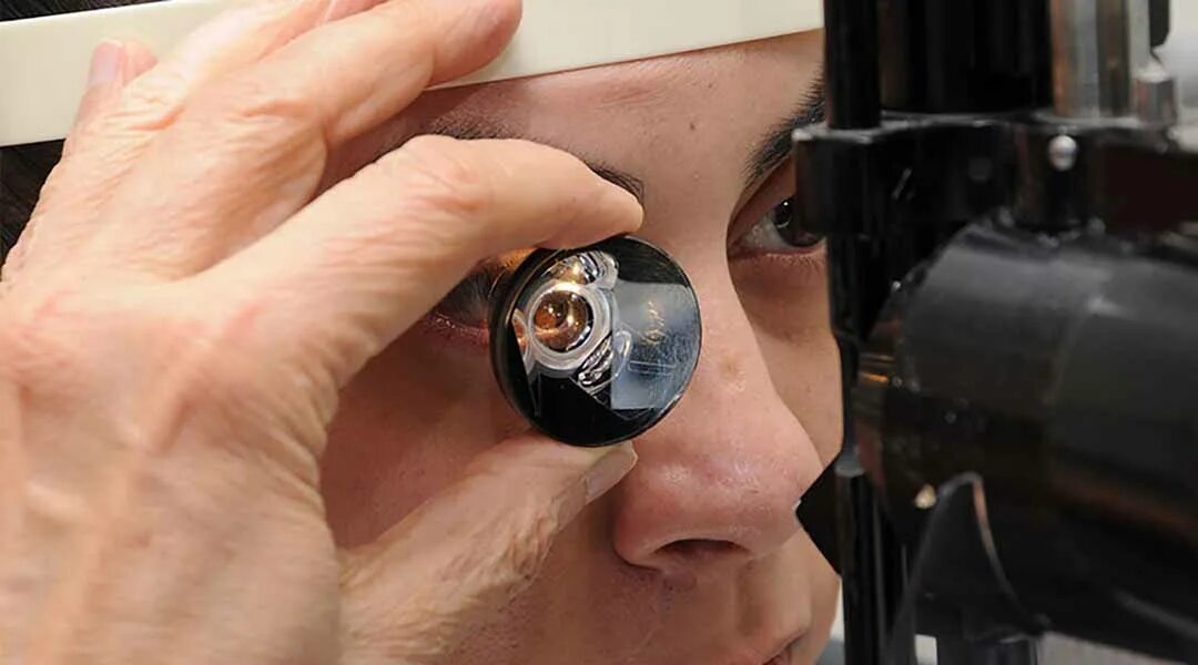 Осмотр глазного дна линзой. Офтальмоскопия с фундус линзой. Осмотр сетчатки с линзой гольдмана. Осмотр с линзой гольдмана. Осмотр глазного дна линзой.