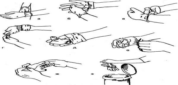 После снятия перчаток руки. Одевание стерильных перчаток алгоритм. Схема одевания стерильных перчаток. Снятие стерильных перчаток алгоритм. Техника одевания стерильных перчаток.
