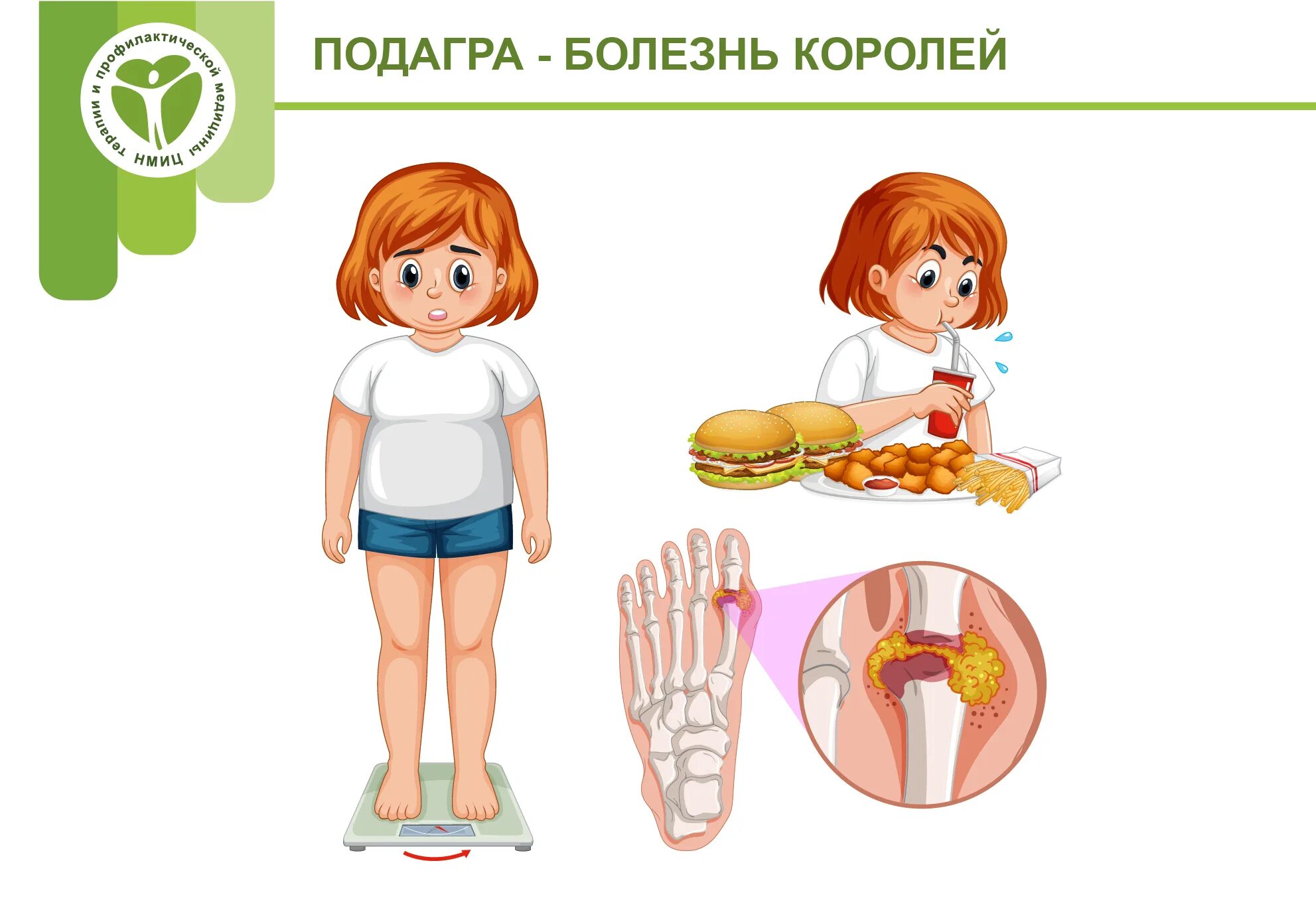 Подагра король. Подагра болезнь королей. подагра болезнь королей и аристократов. подагра болезнь аристократов.