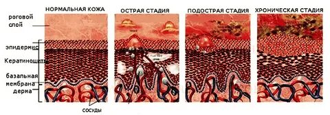 Почему кожа нормальная