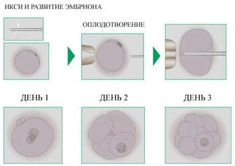 Чем оплодотворение отличается от. Деление клетки после оплодотворения. Оплодотворение яйцеклетки ИКСИ. Эко+ИКСИ этапы. Этапы развития эмбриона при эко.