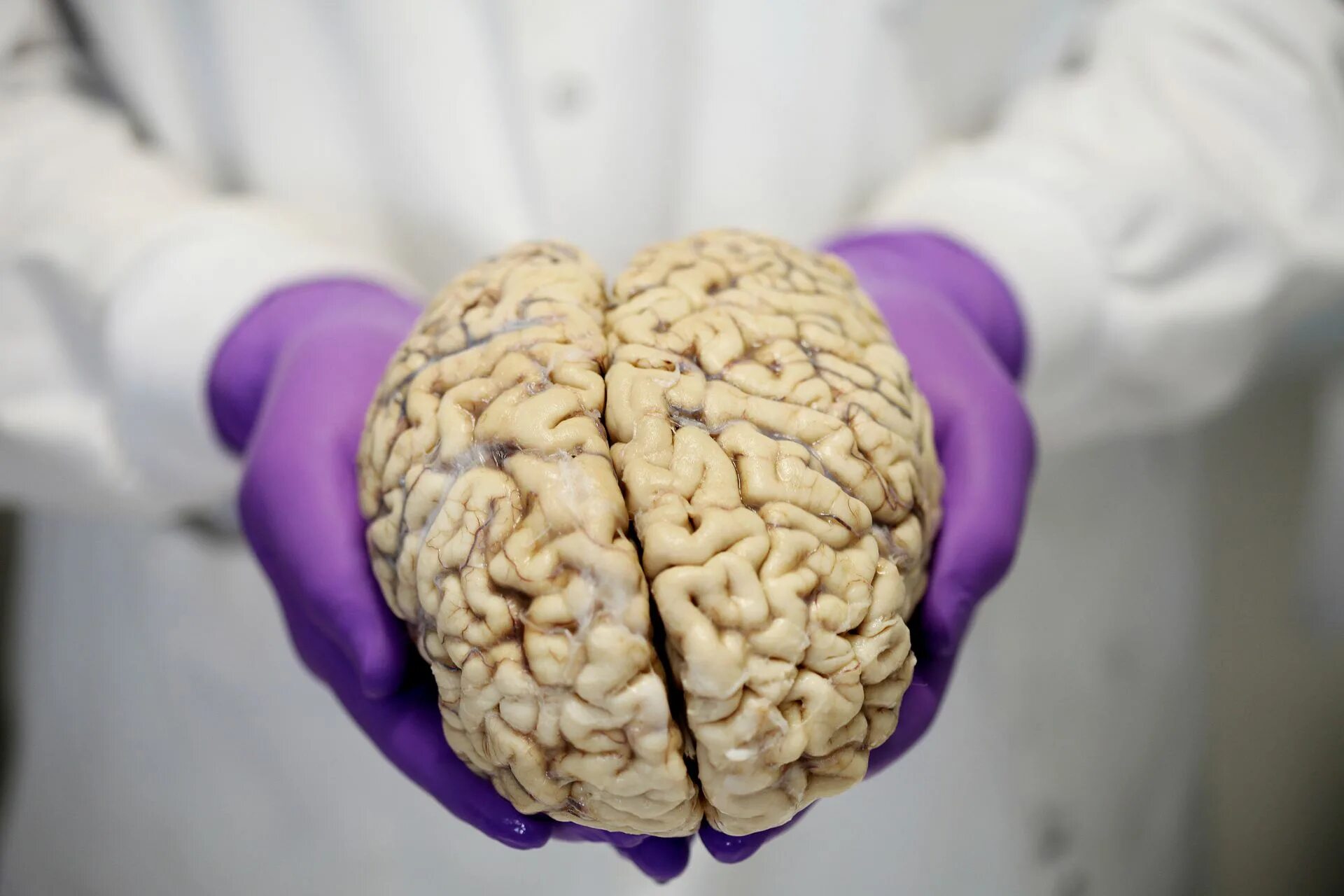 Настоящий человеческий мозг. Человеческий мозг живой.
