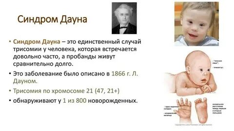 Мутациями являются синдром дауна