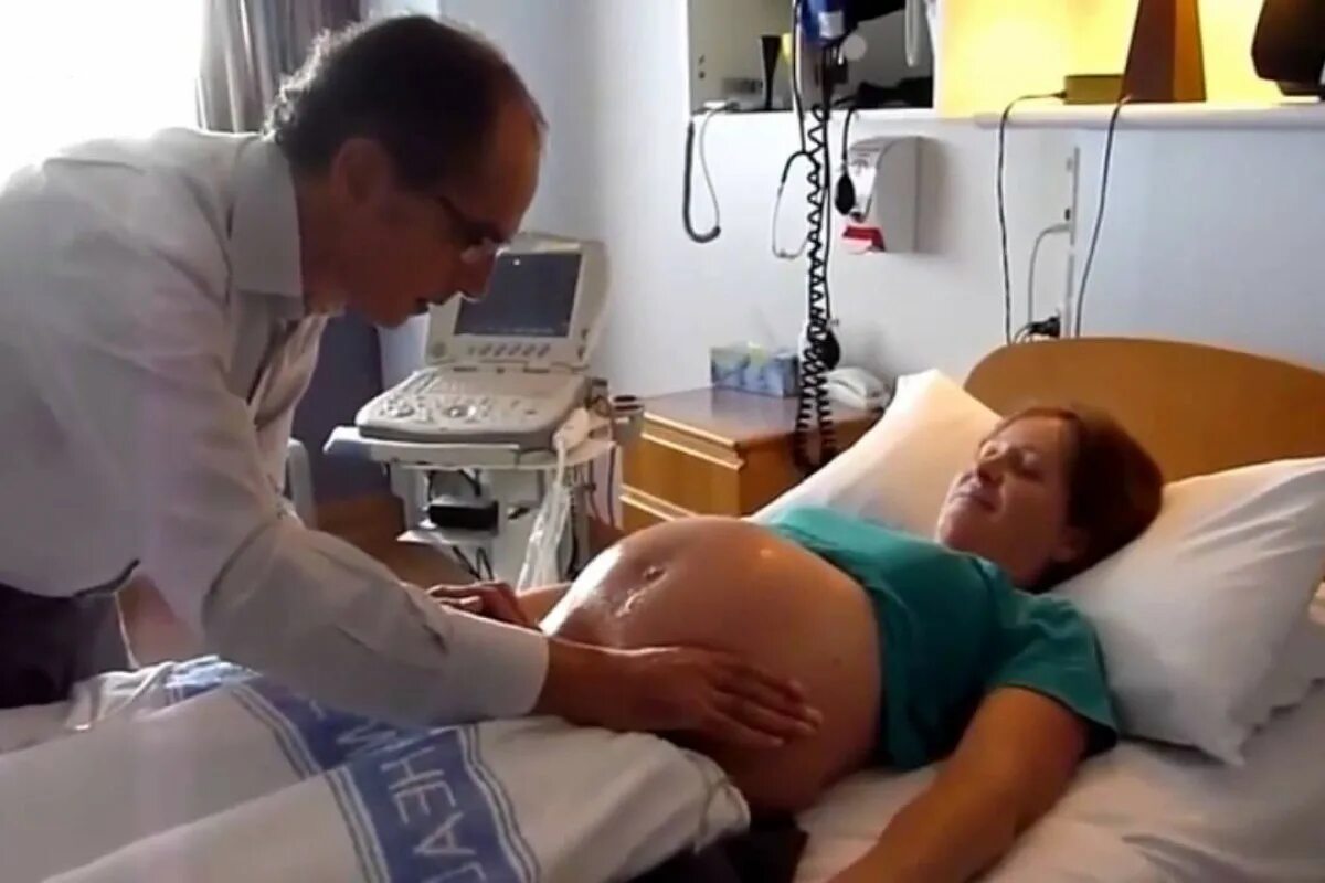 Тазовые роды видео