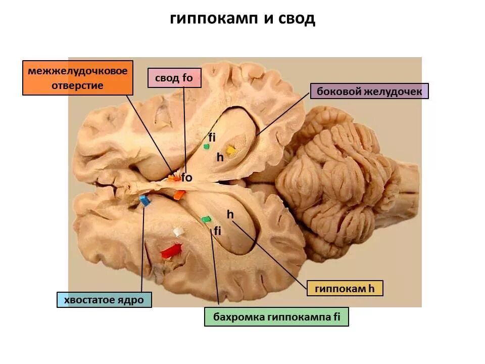 Спайки головного мозга. Гиппокамп головного мозга анатомия. Свод мозга анатомия. Гиппокамп препарат мозга анатомия. Межжелудочковое отверстие.