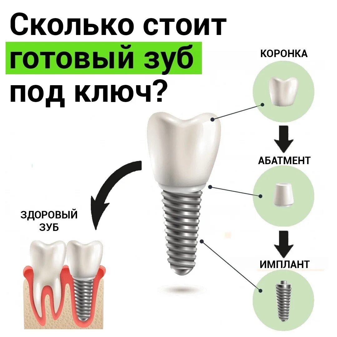 Стоматологические импланты. Дешевый зубной имплант.