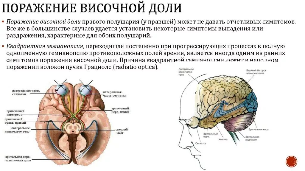 Симптомы поражения височной доли. Синдромы поражения височной доли доминантного полушария. Симптомы поражения коры височной доли головного мозга. Синдром поражения височной доли головного мозга. Расстройство полушарий