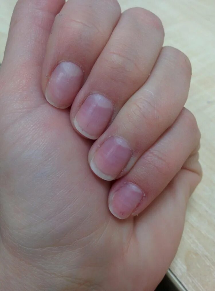 От чего синеют ногти