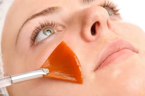 Peel therapy