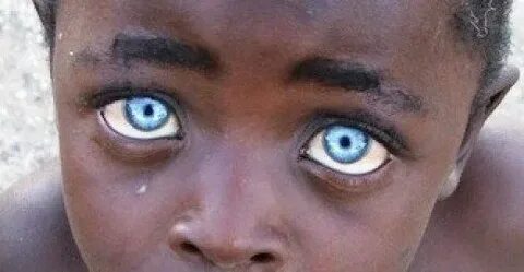 Who has blue eyes