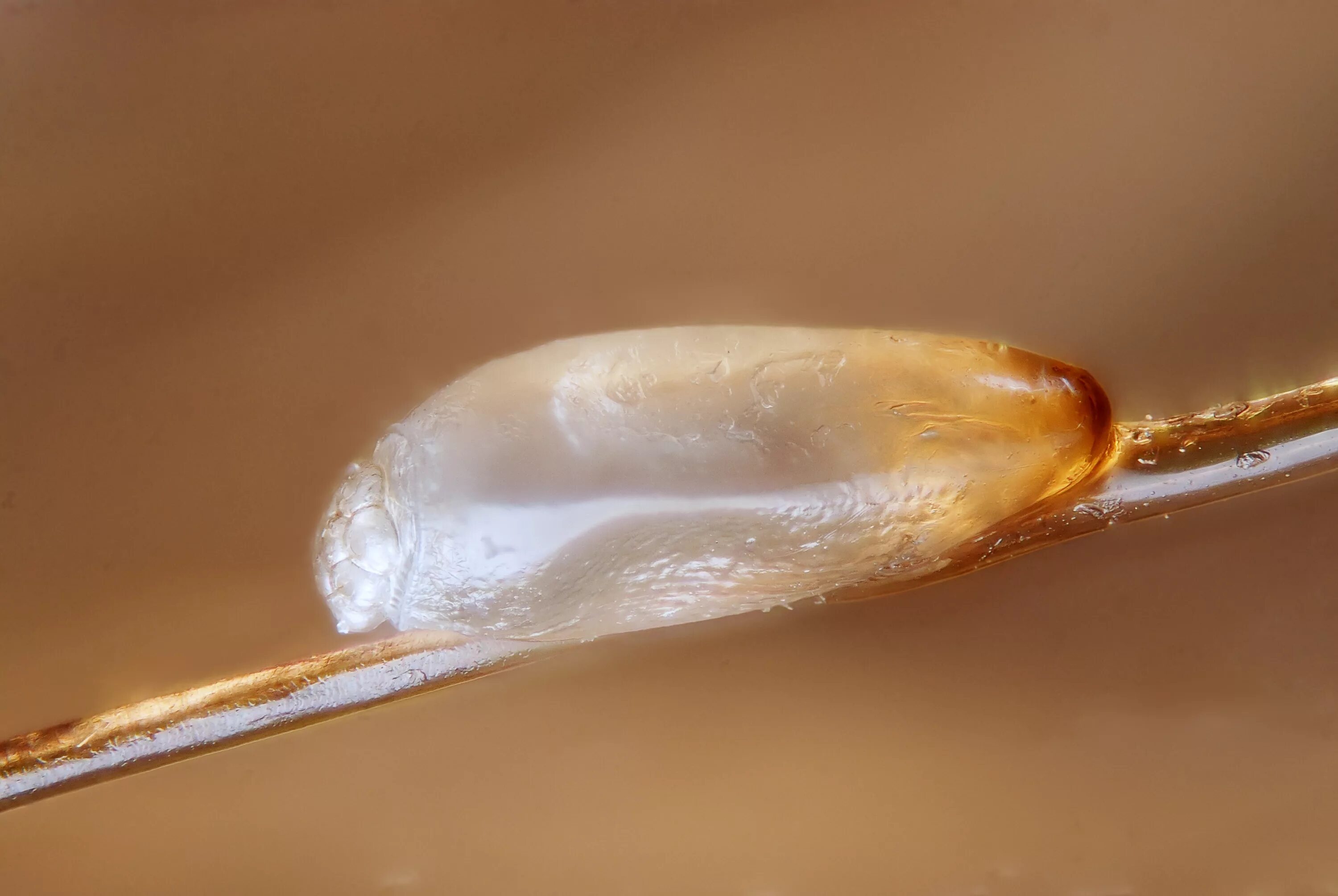 Как выглядят гниды на голове у детей Pin on gross. yuck uggh