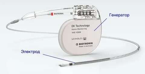 Какой кардиостимулятор ставить