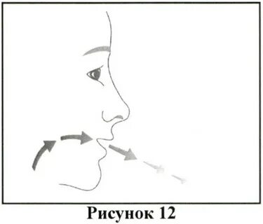 Брезтри аэросфера