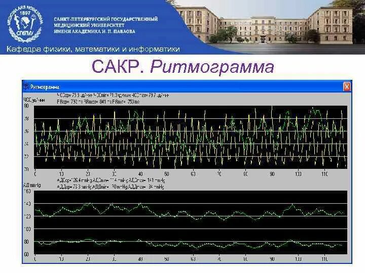 Факультеты физика информатика. Ритмограмма сердца. Ритмограмма ВСР. Спектральный анализ ритмограмм. ЭКГ С ритмограммой.