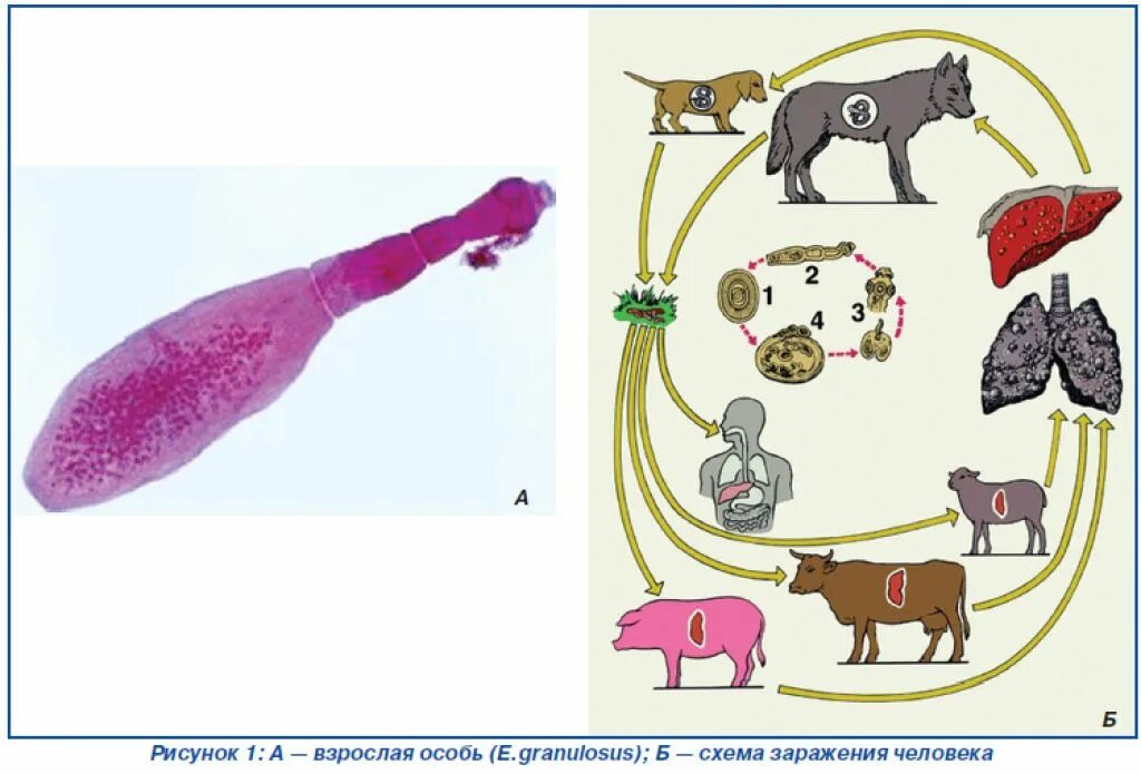 Эхинококки симптомы у людей лечение. Эхинококкоз пути заражения. . Цестодозы (эхинококкоз. Эхинококк пути заражения.