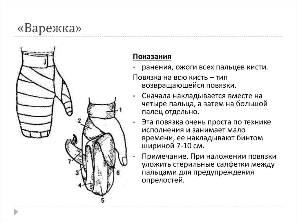 Техника наложения повязки перчатка