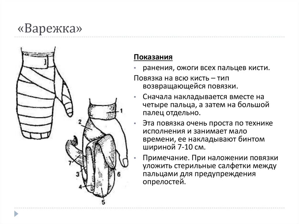 Повязка на кисть алгоритм. Наложение повязки варежка. Повязка варежка на кисть техника наложения. Продемонстрируйте наложение повязки на кисть "варежка".. Схема наложения повязки варежка.