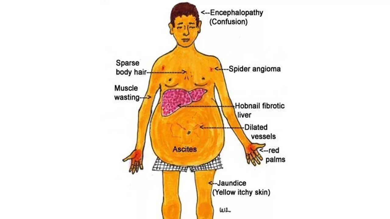 Kota izuba uretse gutanga vitamini D binafite akandi kamaro