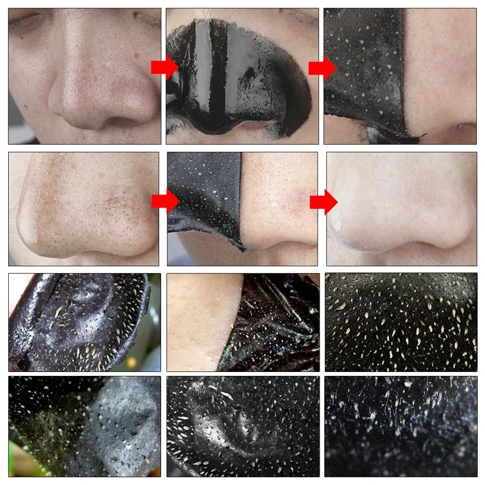 Против прыщей черных точек. Ланбена Blackhead Remover Mask. LANBENA от черных точек чёрная. I'M petie маска для лица от черных точек Blackhead Remover Charcoal Mask - nose strip, 15 g. Маска-пленка от черных точек Pilaten 10 шт.